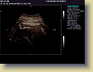 Week32-Siemens-Ultrasound-Dec2011 (6) * 1024 x 768 * (141KB)
